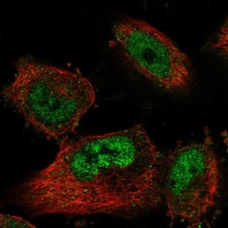 SNRP70 Antibody, Novus Biologicals 25 &mu;L, Unlabeled:Antibodies, Polyclonal